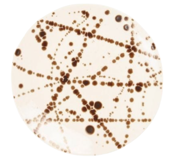 A round petri dish shows intersecting lines and clusters of dark brown bacterial colonies, evoking the distinct bronze splatter finish of Blue Pheasant's Delaney Bronze Splatter Dinnerware.