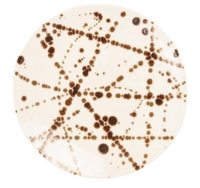 A round petri dish shows intersecting lines and clusters of dark brown bacterial colonies, evoking the distinct bronze splatter finish of Blue Pheasant's Delaney Bronze Splatter Dinnerware.